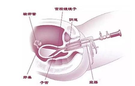 马鞍山人流多少钱