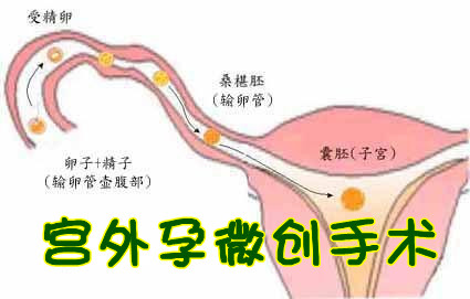 马鞍山人流多少钱