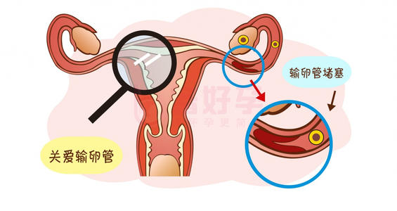 马鞍山无痛人流医院