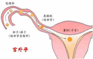 马鞍山无痛人流医院