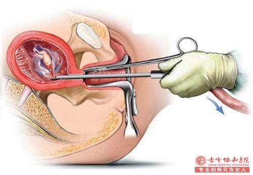 马鞍山做流产哪家医院比较好